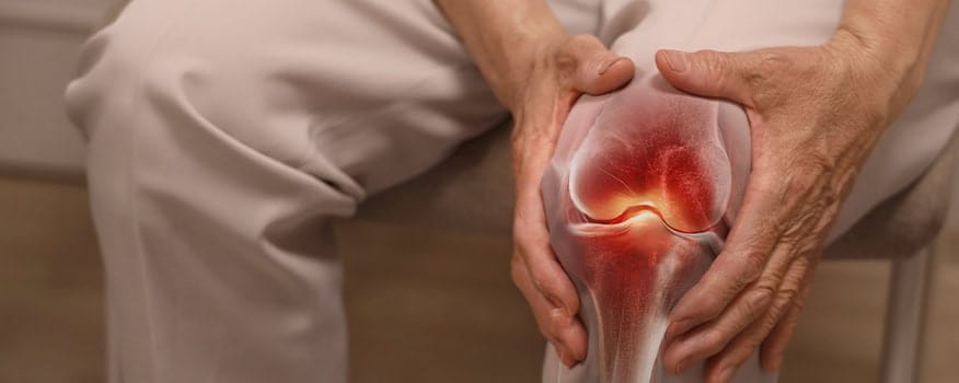 Arthritis Waterbury