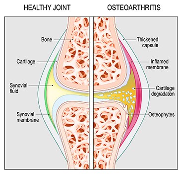 Degenerative Joint Disease Meriden