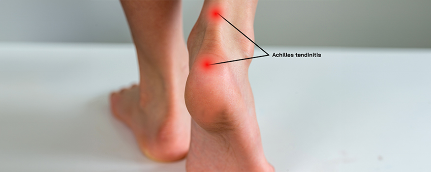 Effective Treatments For Orthopedic Injuries In Connecticut