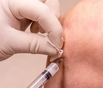 Exosome Therapy for Pain Relief Hartford