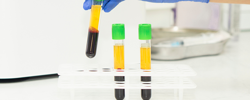 prp injections for joint pain relief at NextGen Health Center in Connecticut
