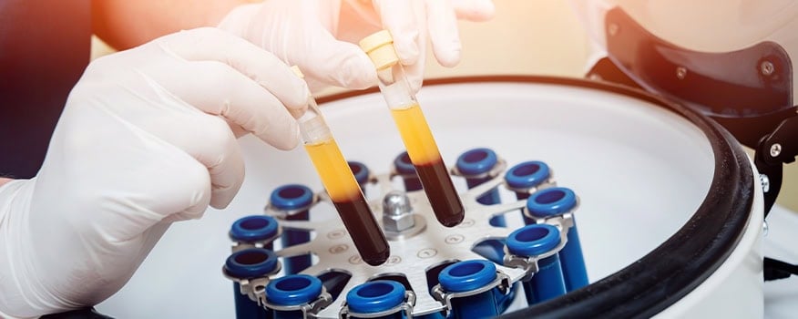 Platelet Rich Plasma Waterbury
