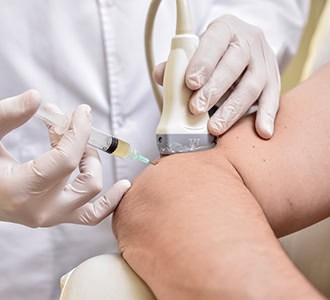 PRP Therapy for Joint Pain Hartford