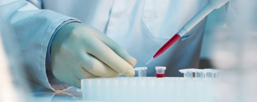 Stem Cell Therapy Waterbury