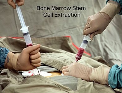 Stem Cells Hartford