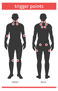 What are Trigger Points? Hartford